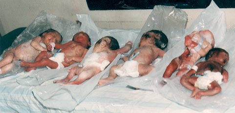 Bombed Iraqi Babies
