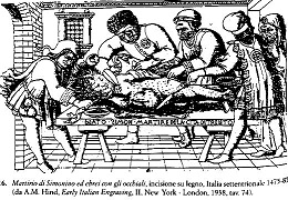 16. Martyrdom of Simonino and Jews with Eyeglasses, woodcut, Northern 