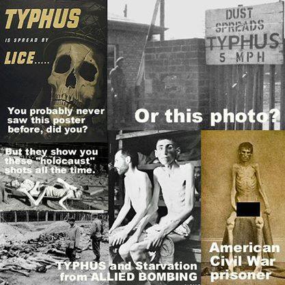 typhus and starvation